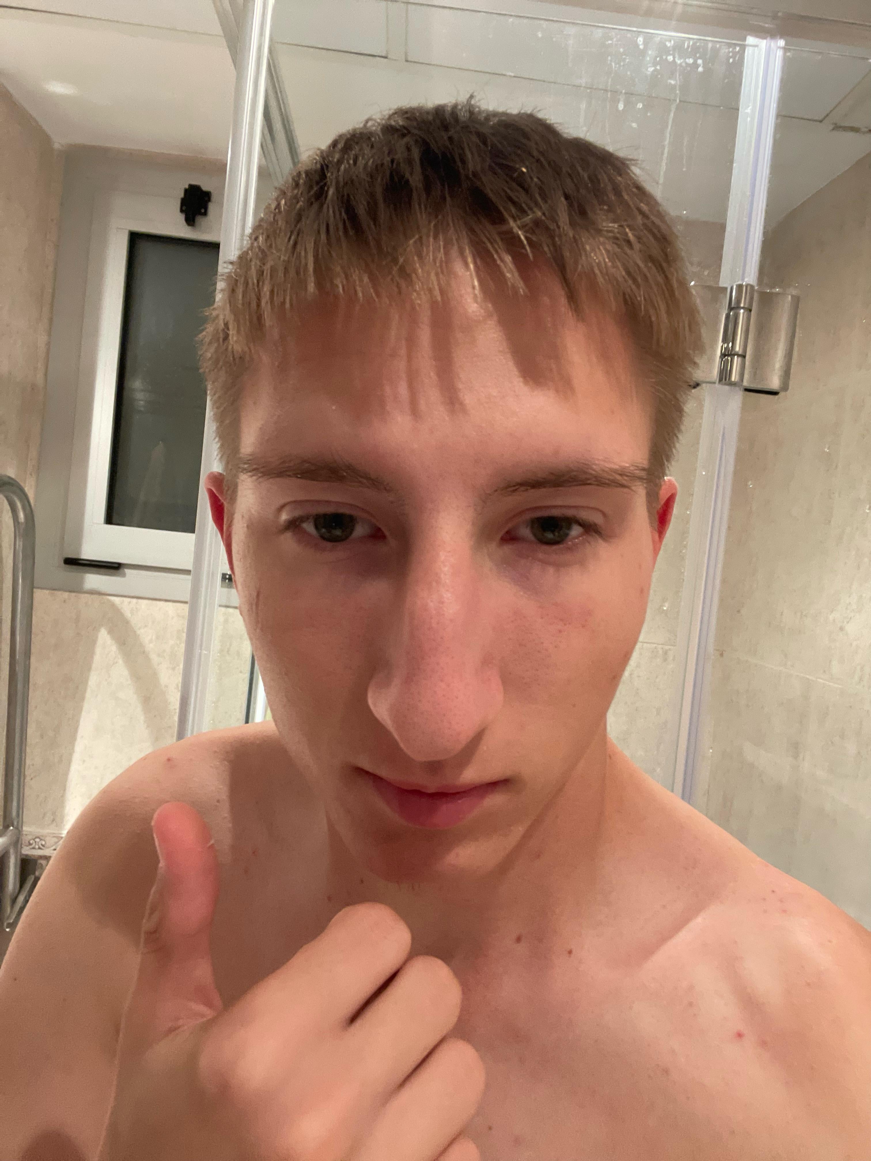 PositiveBlood3168 Volkman